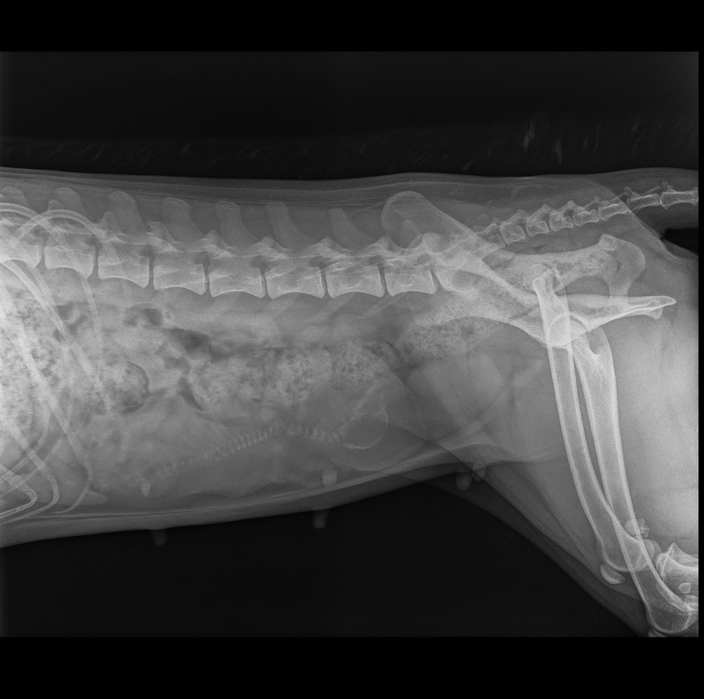 Radiographie de comptage